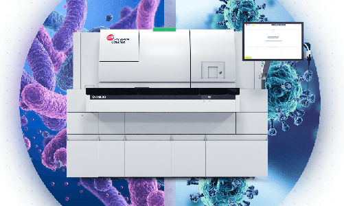 Article sponsorisé laboratoire : Beckman Coulter Diagnostics obtient le marquage CE pour un nouveau test permettant de différencier les infections bactériennes et virales en environ 20 minutes